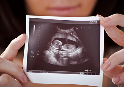 12 неделя беременности от зачатия
